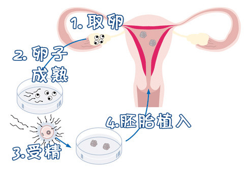 胚胎操作