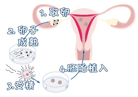 PGT实验室